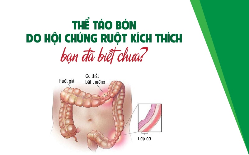 the-tao-bon-do-hoi-chung-ruot-kich-thich-ban-da-biet-chua